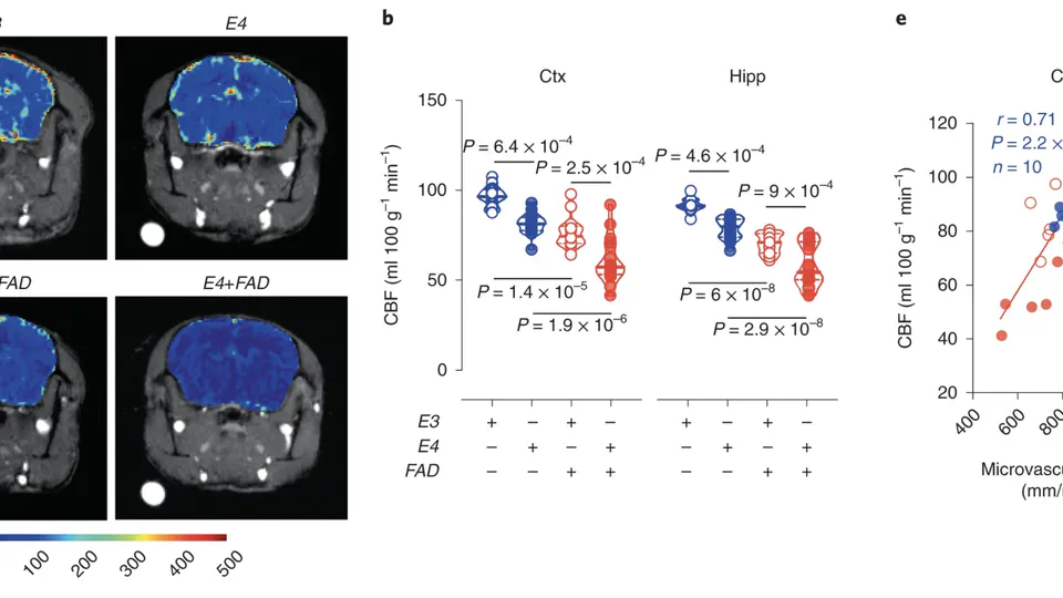 APOE4 accelerates advanced-stage vascular and neurodegenerative disorder in old Alzheimer’s mice via cyclophilin A independently of amyloid-β